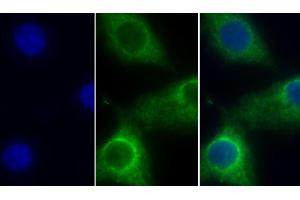 Detection of COX4I1 in Human Hela cell using Polyclonal Antibody to Cytochrome C Oxidase Subunit IV Isoform 1 (COX4I1) (COX IV Antikörper  (AA 1-169))