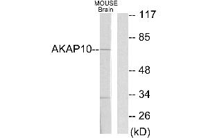 Western blot analysis of extracts from mouse brain cells, using AKAP10 antibody. (AKAP10 Antikörper  (Internal Region))