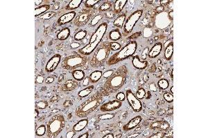 IHC analysis of SBP/SELENBP1 using anti-SBP/SELENBP1 antibody (ABIN7600755). (SELENBP1 Antikörper  (AA 23-462))