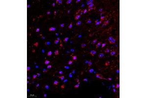 Immunofluorescence of paraffin embedded mouse brain using SRP14 (ABIN7075596) at dilution of 1:300 (400x lens) (SRP14 Antikörper)