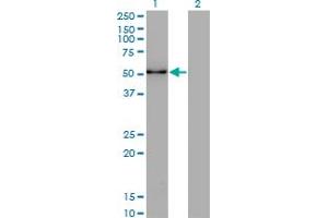 Western Blot analysis of ZSCAN21 expression in transfected 293T cell line by ZNF38 monoclonal antibody (M16), clone 4F10.
