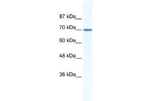 WB Suggested Anti-LAS1L Antibody Titration: 0. (LAS1L Antikörper  (Middle Region))