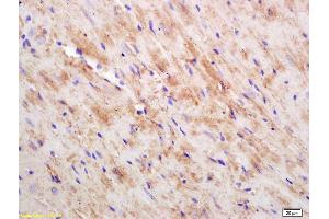 Formalin-fixed and paraffin embedded mouse heart labeled with Rabbit Anti CKMT/Creatine kinase MT Polyclonal Antibody, Unconjugated (ABIN717536) at 1:200 followed by conjugation to the secondary antibody and DAB staining (CKMT1B Antikörper  (AA 115-220))