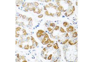 Immunohistochemistry of paraffin-embedded human stomach using CCL2 antibody (ABIN4903158) at dilution of 1:100 (40x lens). (CCL2 Antikörper)