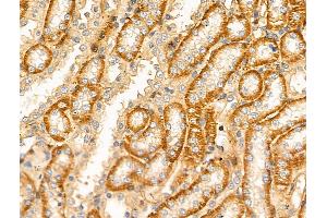 ABIN6256606 and ABIN6268850 at 1/100 staining Rat kidney tissue by IHC-P. (DCT Antikörper  (N-Term))