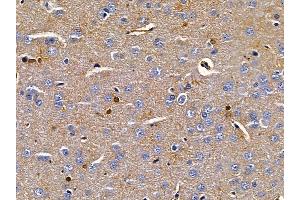 ABIN6258366 and ABIN6275720 at 1/100 staining rat brain tissue by IHC-P.