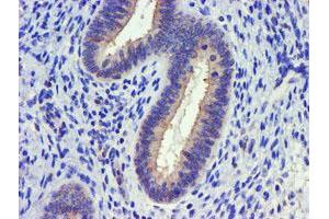 Image no. 1 for anti-Diacylglycerol Kinase, alpha 80kDa (DGKA) antibody (ABIN1497815) (DGKA Antikörper)
