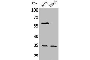 Western Blot analysis of HeLa Raji cells using CD32 Polyclonal Antibody (FCGR2B Antikörper  (C-Term))