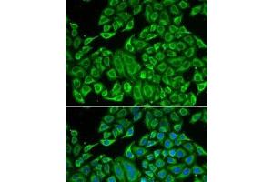 Immunofluorescence analysis of MCF7 cells using IL12RB1 Polyclonal Antibody (IL12RB1 Antikörper)