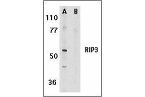 Western blot analysis of RIP3 in mouse 3T3 whole cell lysate in the absence (A) or presence (B) of blocking peptide with RIP3 antibody at 1 μg/ml. (RIPK3 Antikörper  (AA 473-486))