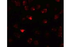 Immunofluorescencent staining of 3T3 cells with PIWIL3 polyclonal antibody  at 20 ug/mL. (PIWIL3 Antikörper  (N-Term))