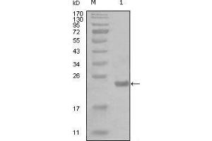 Western blot analysis using CHUK mouse mAb against truncated Trx-CHUK recombinant protein (1). (IKK alpha Antikörper  (AA 500-590))