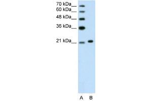 Ankyrin 1 antibody used at 1. (Erythrocyte Ankyrin Antikörper  (C-Term))