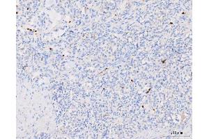 IHC analysis of Grancalcin/GCA using anti-Grancalcin/GCA antibody (ABIN6719568).