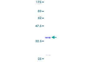 MRPS21 Protein (AA 1-87) (GST tag)