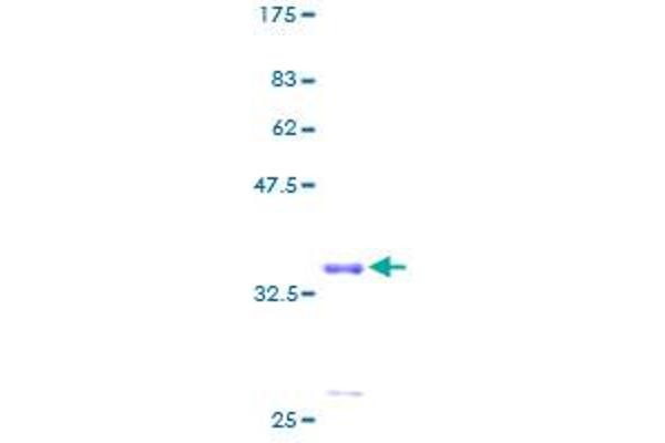 MRPS21 Protein (AA 1-87) (GST tag)