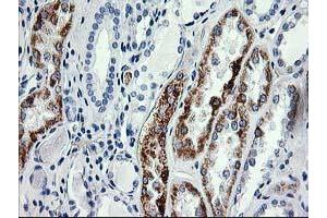 Immunohistochemical staining of paraffin-embedded Human Kidney tissue using anti-AK4 mouse monoclonal antibody. (AK4 Antikörper)