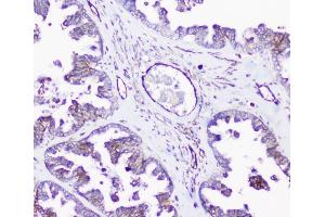 IHC analysis of INPPL1 using anti-INPPL1 antibody (ABIN6719492).