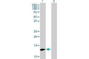 Western Blot analysis of FBXW9 expression in transfected 293T cell line by FBXW9 MaxPab polyclonal antibody. (FBXW9 Antikörper  (AA 1-135))