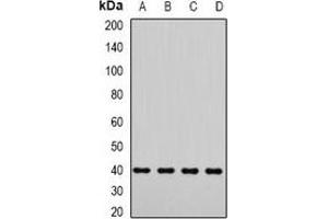 Western blot analysis of LIC3 expression in Jurkat (A), A549 (B), mouse testis (C), rat testis (D) whole cell lysates. (DYNC2LI1 Antikörper)