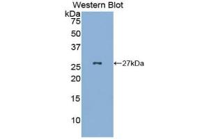 Detection of Recombinant GKN2, Mouse using Polyclonal Antibody to Gastrokine 2 (GKN2) (Gastrokine 2 Antikörper  (AA 21-184))