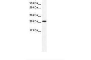 Image no. 1 for anti-Four and A Half LIM Domains 1 (FHL1) (AA 207-256) antibody (ABIN202152)