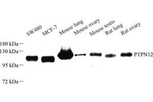 PTPN12 Antikörper