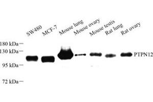 Western blot analysis of PTPN12 (ABIN7075292) at dilution of 1: 500 (PTPN12 Antikörper)