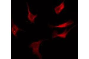 ABIN6276089 staining COLO205 by IF/ICC. (OR52D1 Antikörper  (C-Term))