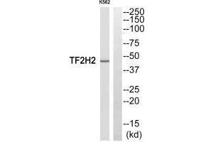 Western blot analysis of extracts from COLO205 cells, using TF2H2 antibody.