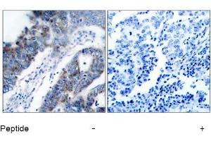 Image no. 1 for anti-Mitogen-Activated Protein Kinase Kinase Kinase 5 (MAP3K5) (Ser83) antibody (ABIN197310) (ASK1 Antikörper  (Ser83))