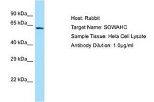 Image no. 1 for anti-Ankyrin Repeat Domain 57 (ANKRD57) (AA 128-177) antibody (ABIN6750153) (ANKRD57 Antikörper  (AA 128-177))