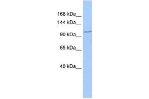 IFT122 antibody used at 1 ug/ml to detect target protein. (IFT122 Antikörper)