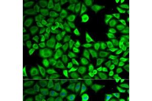 Immunofluorescence analysis of HeLa cells using LTA4H Polyclonal Antibody (LTA4H Antikörper)