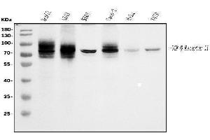 Western blot analysis of TGFBR2 using anti-TGFBR2 antibody (ABIN7603157).