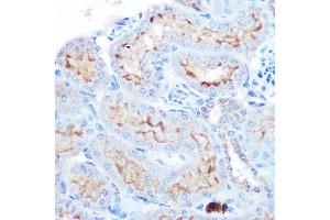 Immunohistochemistry of paraffin-embedded human esophageal using TNFSF13B Rabbit pAb (ABIN6127582, ABIN6149343, ABIN6149344 and ABIN6221563) at dilution of 1:100 (40x lens). (BAFF Antikörper  (AA 76-285))
