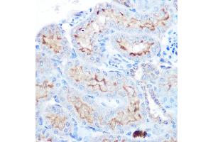 Immunohistochemistry of paraffin-embedded human esophageal using TNFSF13B Rabbit pAb (ABIN6127582, ABIN6149343, ABIN6149344 and ABIN6221563) at dilution of 1:100 (40x lens).