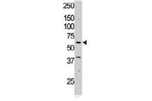 The RYK polyclonal antibody  is used in Western blot to detect RYK in Jurkat cell lysate.