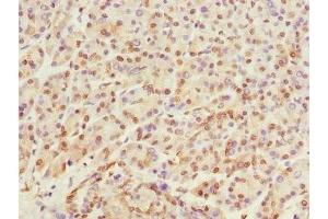 Immunohistochemistry of paraffin-embedded human pancreatic tissue using ABIN7167513 at dilution of 1:100 (PTPRO Antikörper  (AA 30-300))