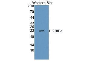 Western Blotting (WB) image for anti-Interleukin 5 Receptor, alpha (IL5RA) (AA 41-203) antibody (ABIN3206508) (IL5RA Antikörper  (AA 41-203))