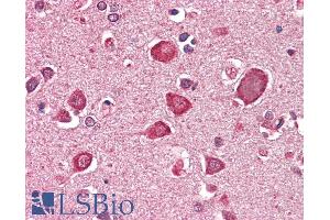 Immunohistochemistry (IHC) image for anti-gamma-aminobutyric Acid (GABA) A Receptor, alpha 6 (GABRA6) (AA 15-26) antibody (ABIN1590079)