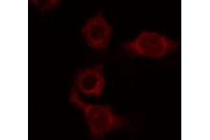ABIN6274126 staining COLO205 by IF/ICC. (ATP6AP2 Antikörper  (Internal Region))