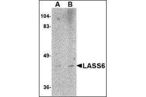 Western blot analysis of LASS6 in rat brain tissue lysate AP30493PU-N at (A) 1 and (B) 2 μg/ml. (CERS6 Antikörper  (N-Term))