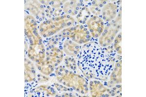 Immunohistochemistry of paraffin-embedded mouse kidney using ANTXR2 antibody (ABIN5975032) at dilution of 1/100 (40x lens). (ANTXR2 Antikörper)