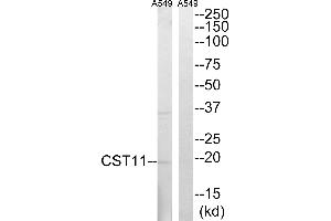 Western blot analysis of extracts from A549 cells, using CST11 antibody. (CST11 Antikörper)