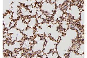 ABIN6274127 at 1/100 staining Mouse lung tissue by IHC-P. (BCAR3 Antikörper  (C-Term))