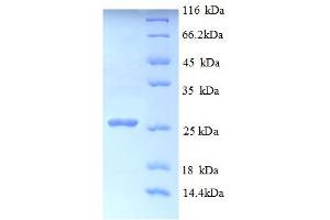 SDS-PAGE (SDS) image for Myelin Transcription Factor 1 (MYT1) (AA 900-1101), (partial) protein (His tag) (ABIN5713002) (MYT1 Protein (AA 900-1101, partial) (His tag))
