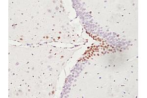 Formalin-fixed and paraffin embedded rat brain labeled with Anti-ATF6 Polyclonal Antibody, unconjugated (ABIN732293) followed by incubation with conjugated secondary antibody and DAB staining
