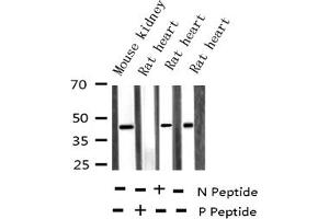 Western blot analysis of Phospho-MKK3 (Ser189) expression in various lysates (MAP2K3 Antikörper  (pSer189))
