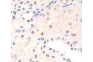 Used in DAB staining on fromalin fixed paraffin- embedded Kidney tissue (Protein Red (IK) (AA 1-192) Antikörper)